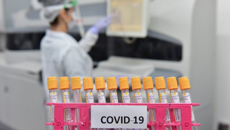 ANS obriga planos de saúde a incluírem teste sorológico da covid-19