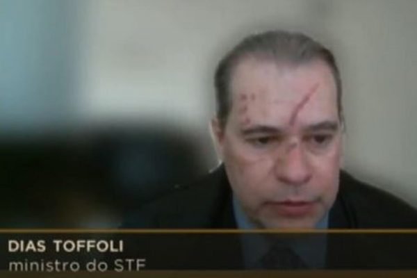 Ministro Dias Toffoli surge com hematomas no rosto em sessão do STF