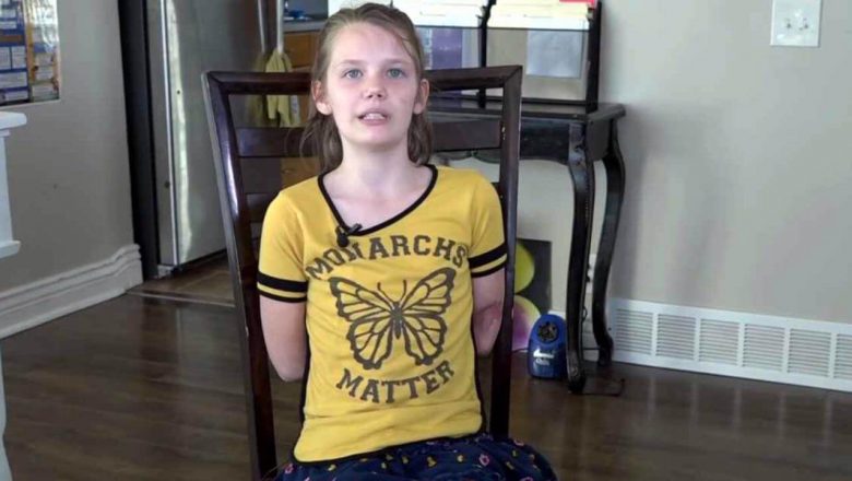 Menina de 9 anos que perdeu braços e pernas em acidente inspira com sua fé