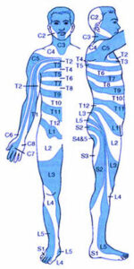 Entenda melhor o que significa fratura na vertebra T5